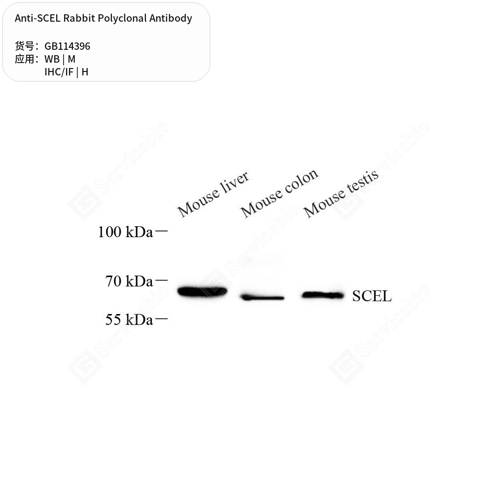 Антитела первичные, поликлональные кролика к SCEL мыши, человека, 100 мкл