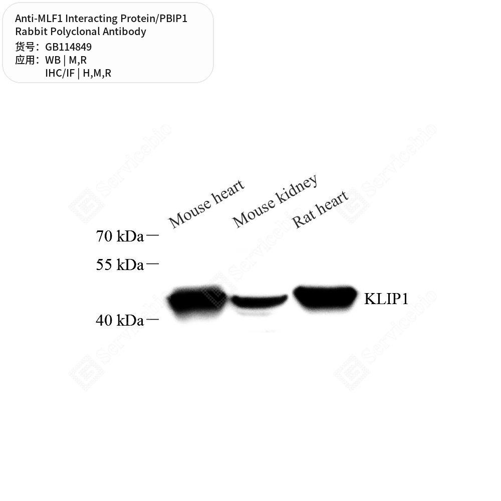 Антитела первичные, поликл. кролика к MLF1 Interacting Protein/PBIP1 крысы, мыши, человека, 50 мкл