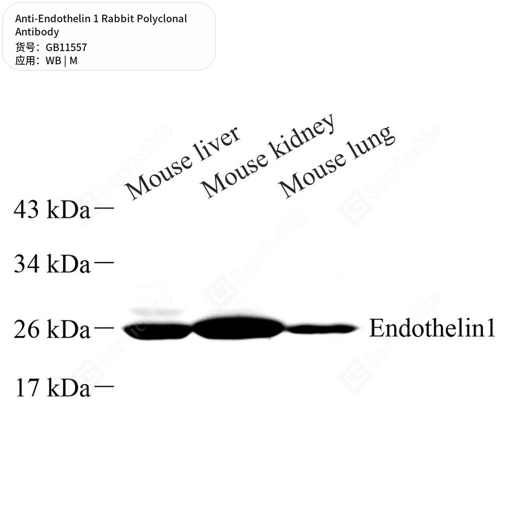 Антитела первичные, поликлональные кролика к Endothelin 1 мыши, 100 мкл