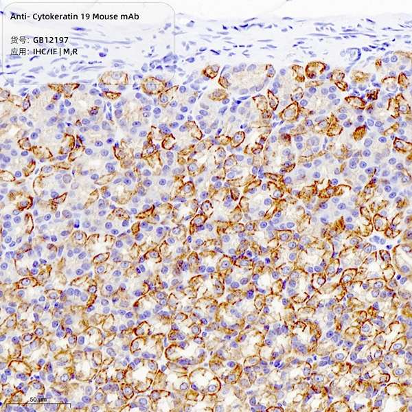 Антитела первичные, моноклональные, Cytokeratin 19, 100 мкл