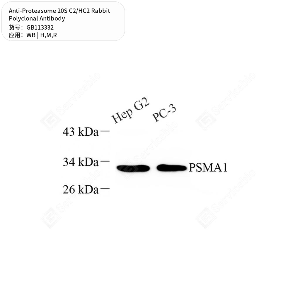Антитела первичные, поликлональные кролика к Proteasome 20S C2/HC2 крысы, мыши, человека, 50 мкл
