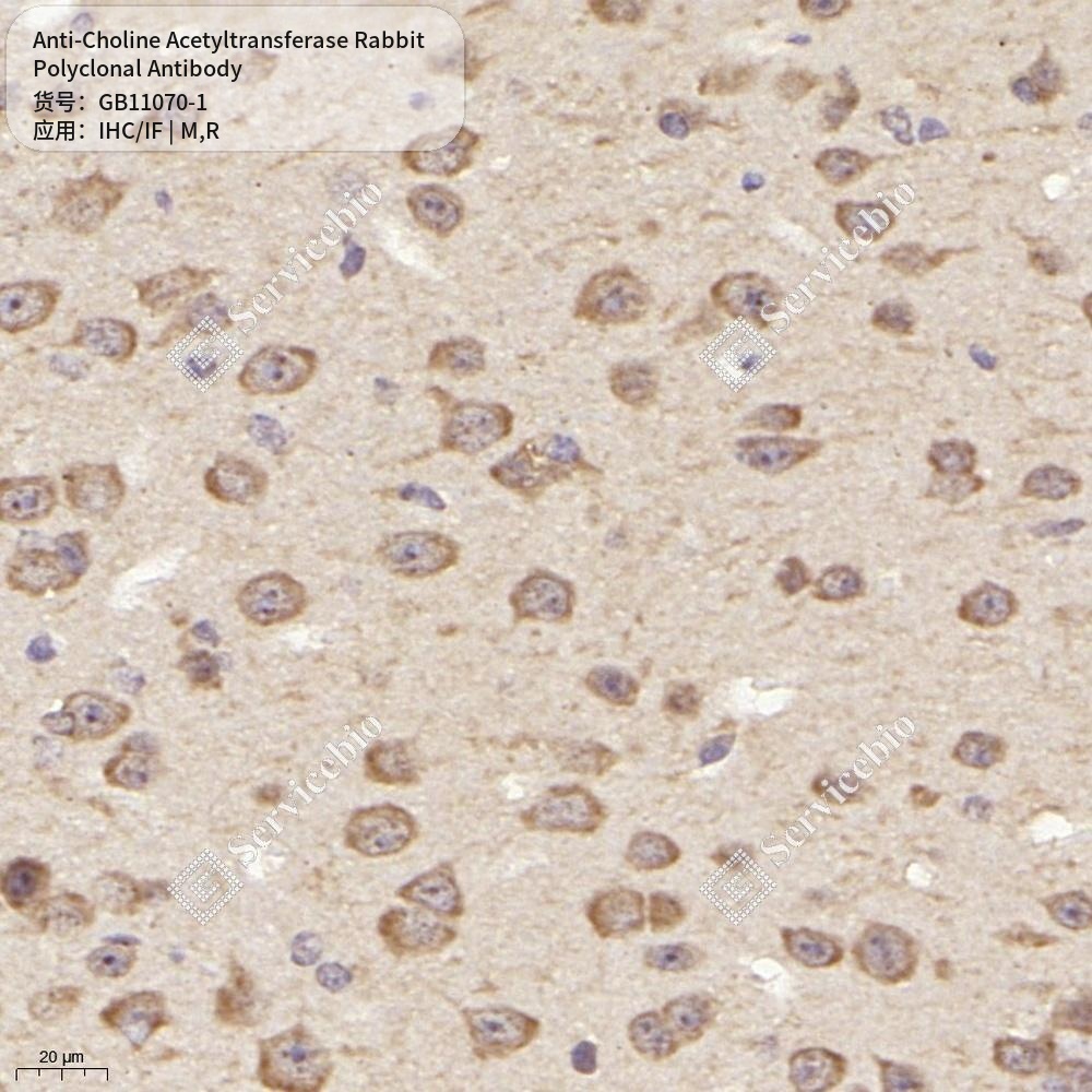Антитела первичные, поликлональные кролика к Choline Acetyltransferase крысы, мыши, 100 мкл