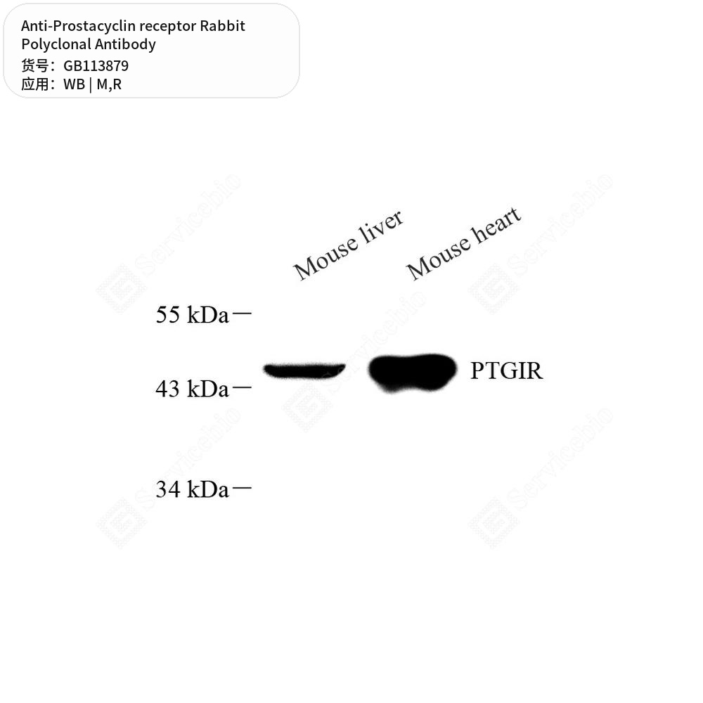Антитела первичные, поликлональные кролика к Prostacyclin receptor крысы, мыши, 100 мкл