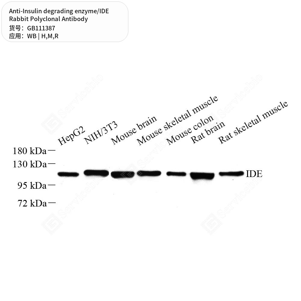 Антитела первичные, поликл. кролика к Insulin degrading enzyme/IDE крысы, мыши, человека, 100 мкл