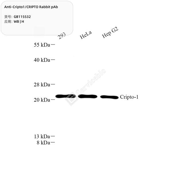 Антитела первичные, поликлональные, Cripto1/CRIPTO, 100 мкл
