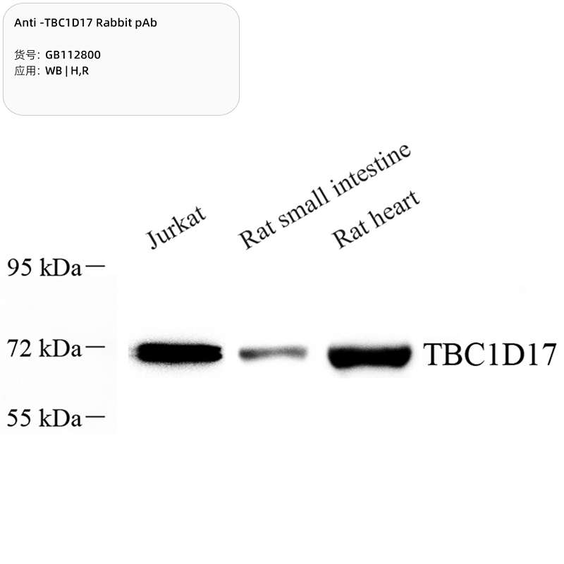 Антитела первичные, поликлональные, TBC1D17, 100 мкл