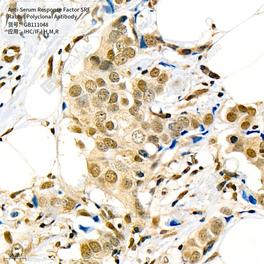Антитела первичные, поликл. кролика к Serum Response Factor SRF крысы, мыши, человека, 100 мкл