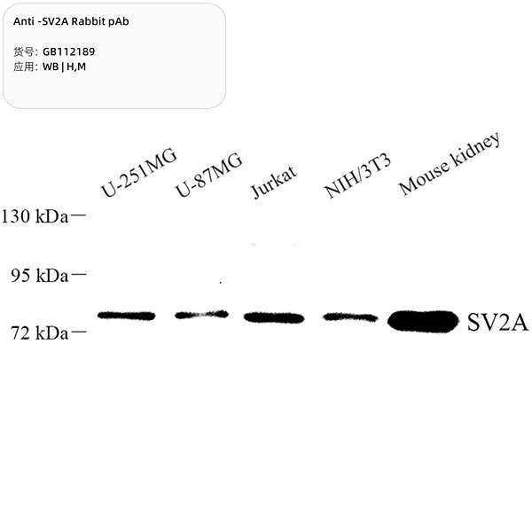 Антитела первичные, поликлональные, SV2A, 100 мкл