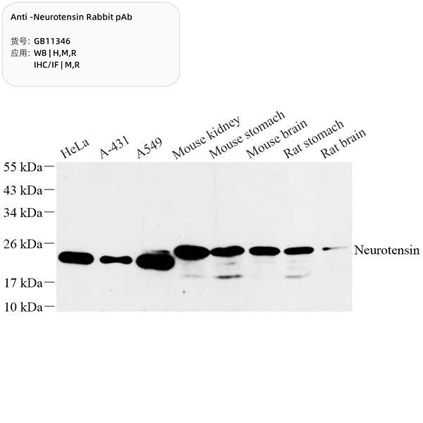 Антитела первичные, поликлональные, Neurotensin, 100 мкл