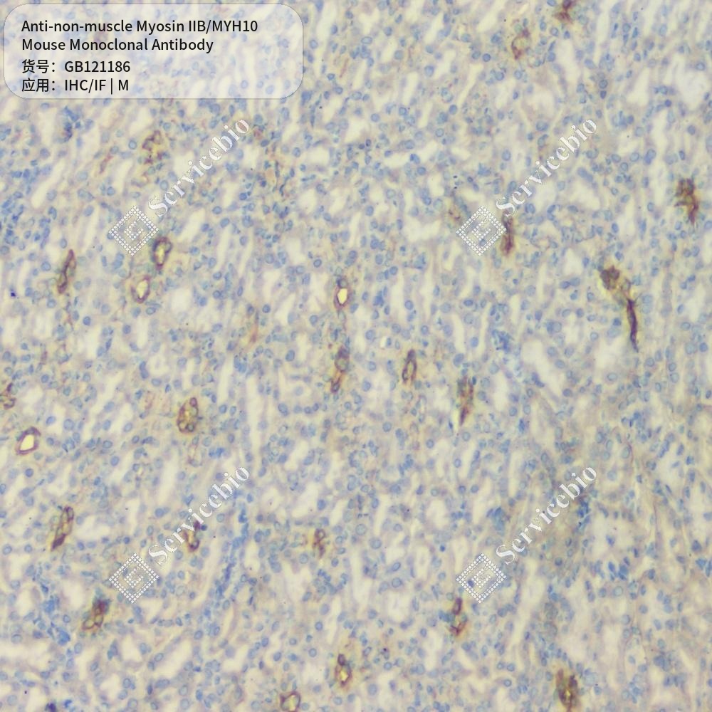 Антитела первичные, моноклональные мыши к non-muscle Myosin IIB/MYH10 мыши, 50 мкл