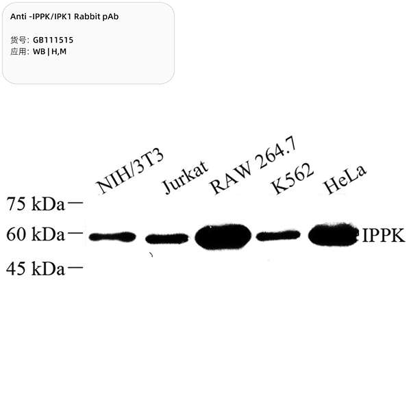 Антитела первичные, поликлональные, IPPK/IPK1, 100 мкл