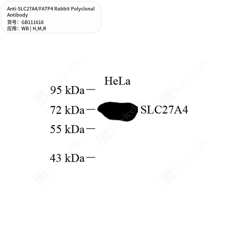 Антитела первичные, поликлональные кролика к SLC27A4/FATP4 крысы, мыши, человека, 100 мкл
