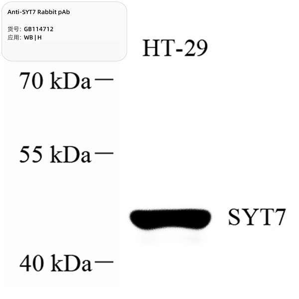 Антитела первичные, поликлональные, SYT7, 100 мкл