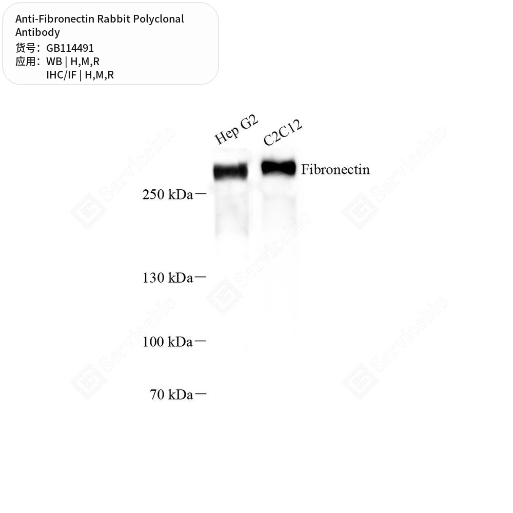 Антитела первичные, поликлональные кролика к Fibronectin крысы, мыши, человека, 50 мкл