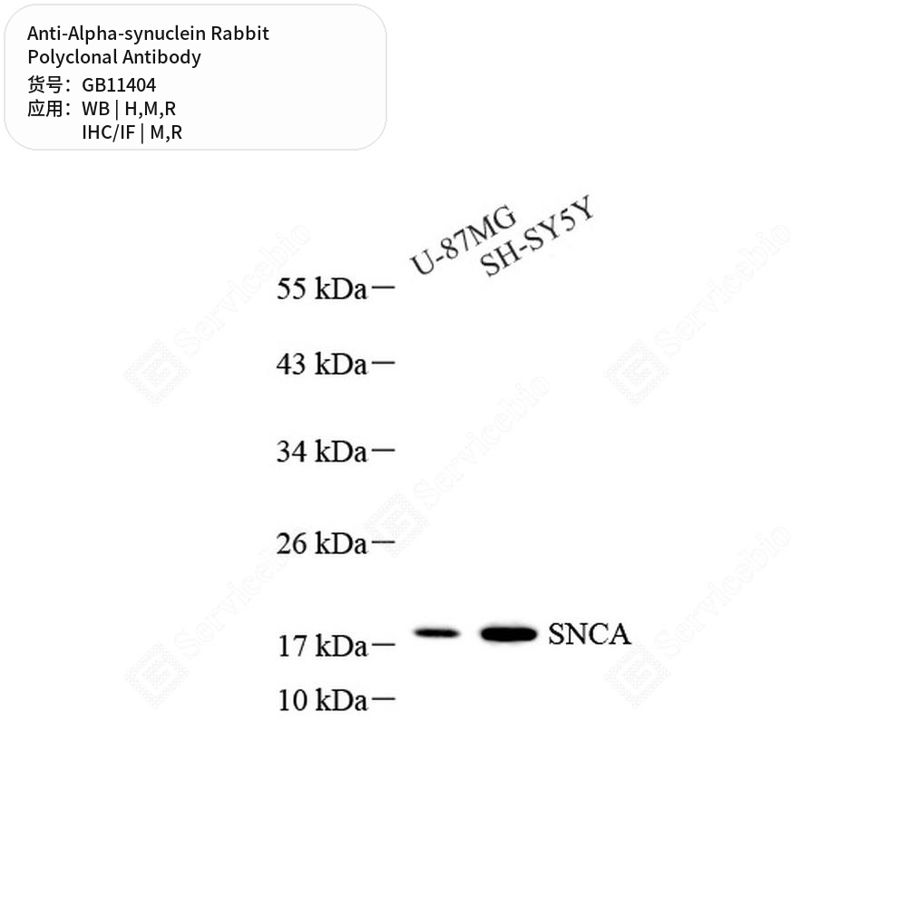 Антитела первичные, поликлональные кролика к Alpha-synuclein крысы, мыши, человека, 100 мкл