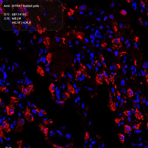 Антитела первичные, поликлональные, SFTPA1, 100 мкл