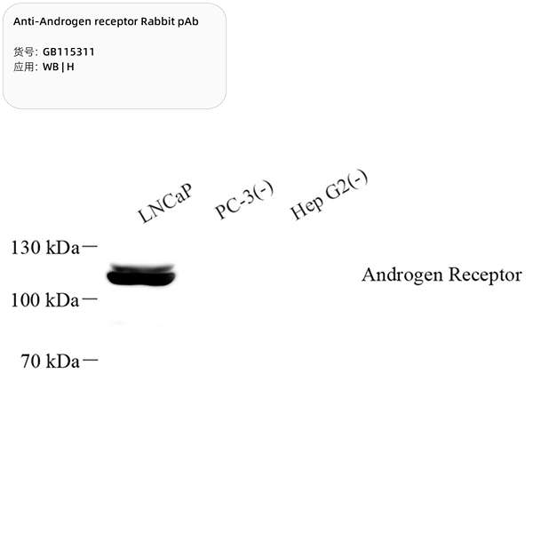 Антитела первичные, поликлональные, Androgen receptor, 100 мкл