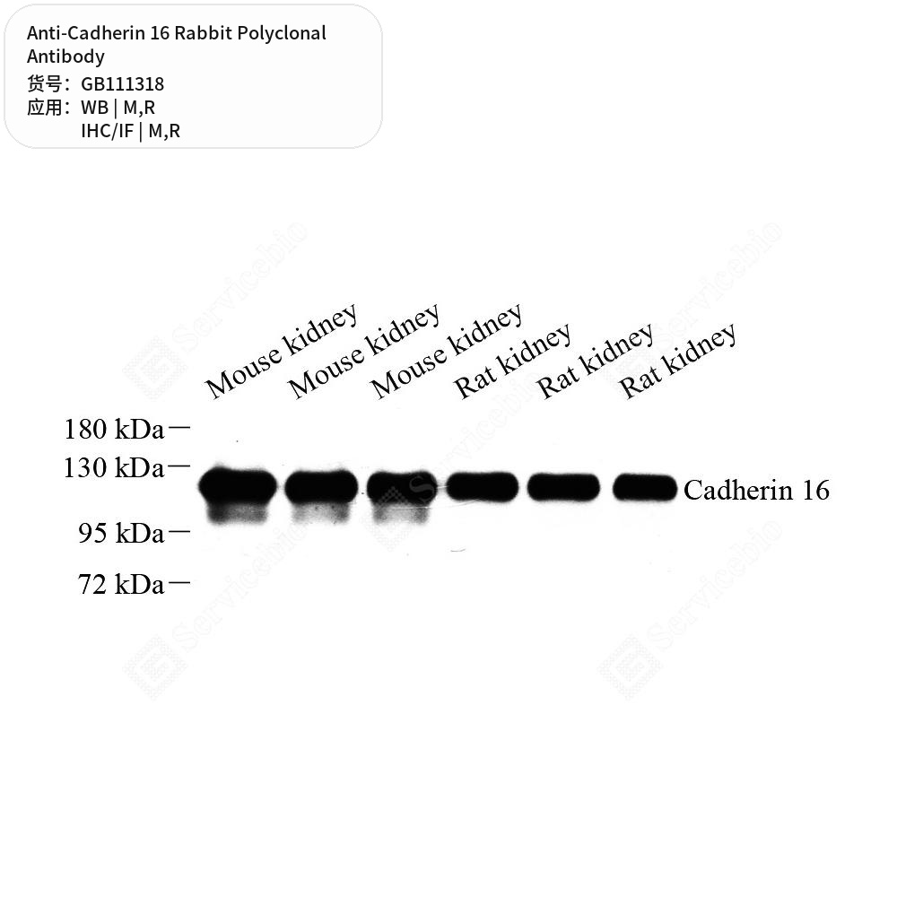 Антитела первичные, поликлональные кролика к Cadherin 16 крысы, мыши, 100 мкл