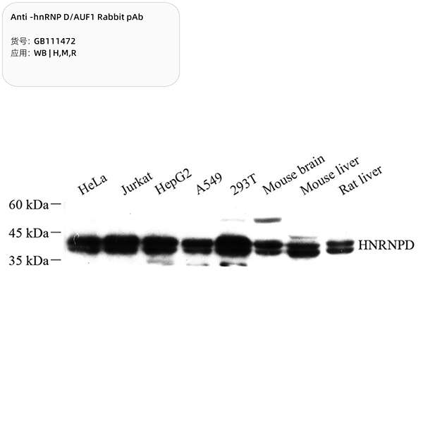 Антитела первичные, поликлональные, hnRNP D/AUF1, 100 мкл