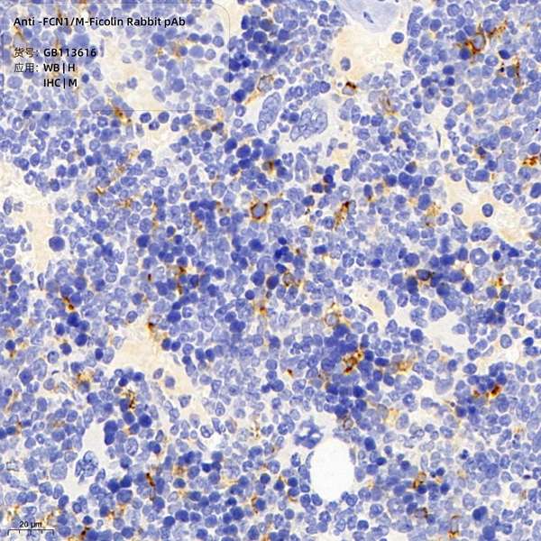 Антитела первичные, поликлональные, FCN1/M-Ficolin, 100 мкл