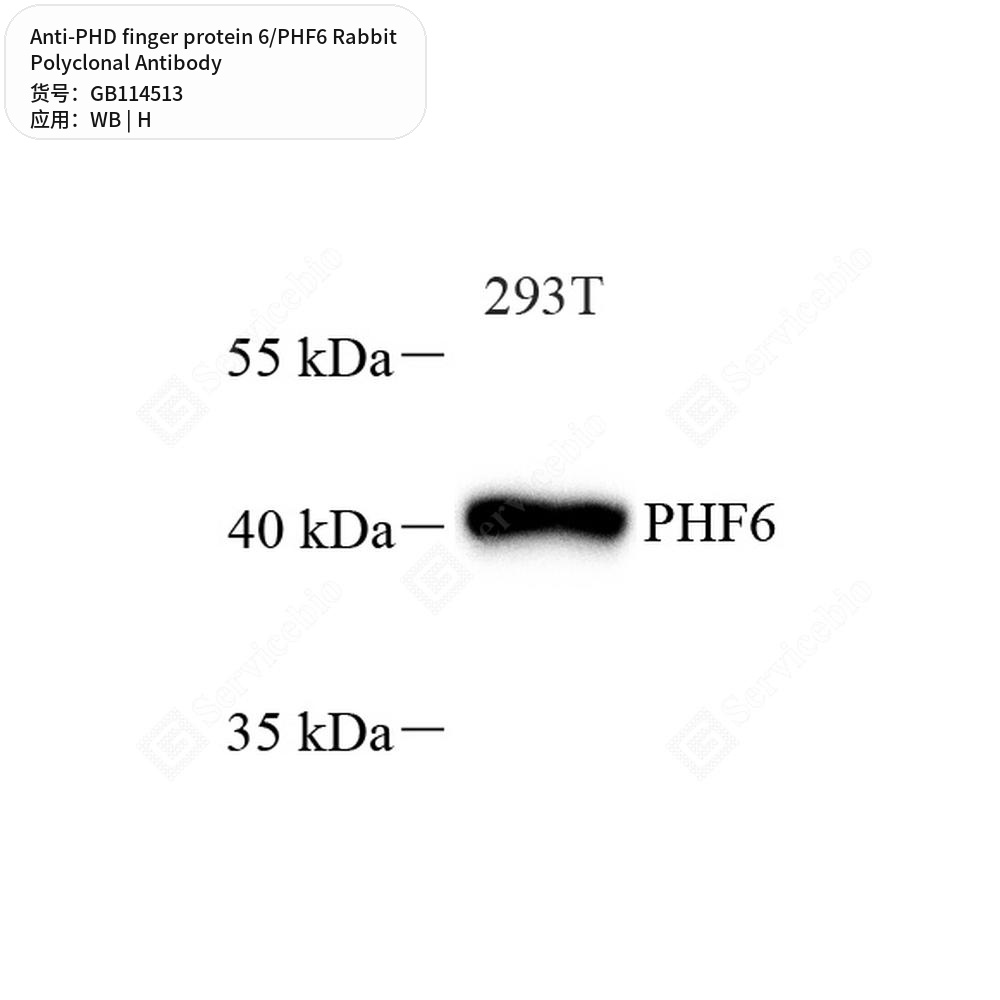 Антитела первичные, поликлональные кролика к PHD finger protein 6/PHF6 человека, 100 мкл