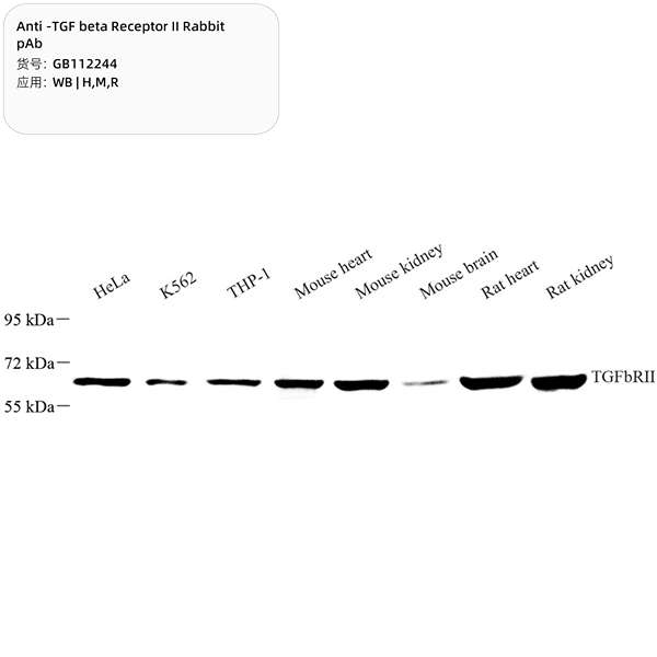 Антитела первичные, поликлональные, TGF beta Receptor II, 100 мкл