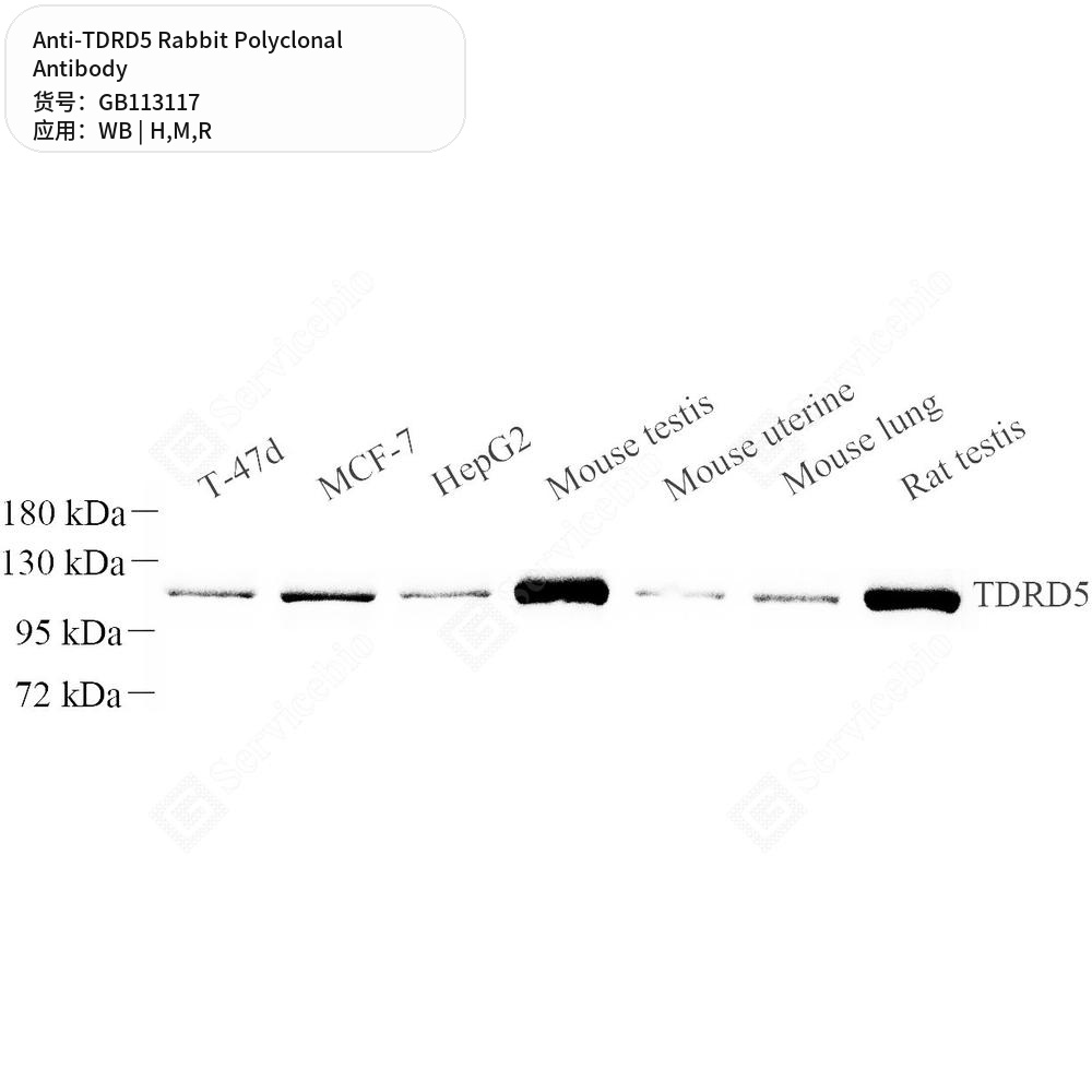 Антитела первичные, поликлональные кролика к TDRD5 крысы, мыши, человека, 50 мкл