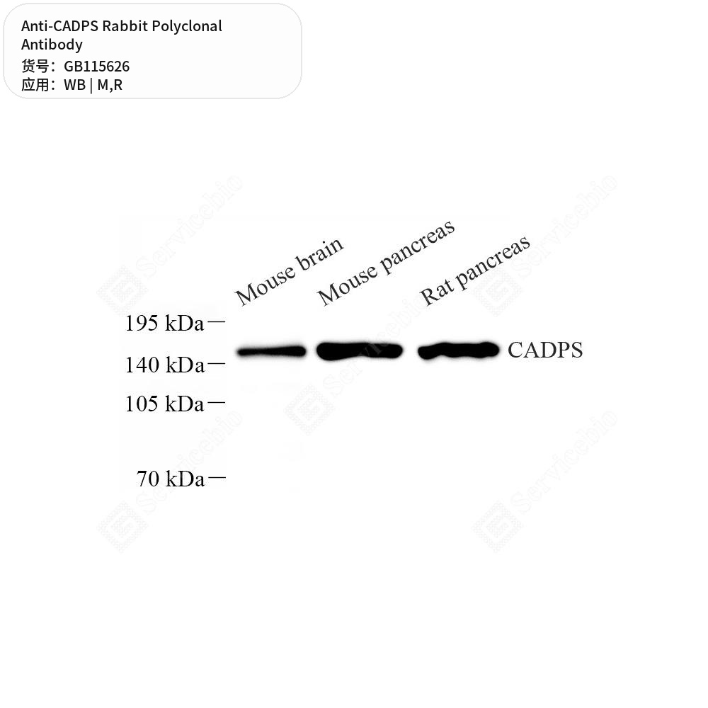 Антитела первичные, поликлональные кролика к CADPS крысы, мыши, 50 мкл