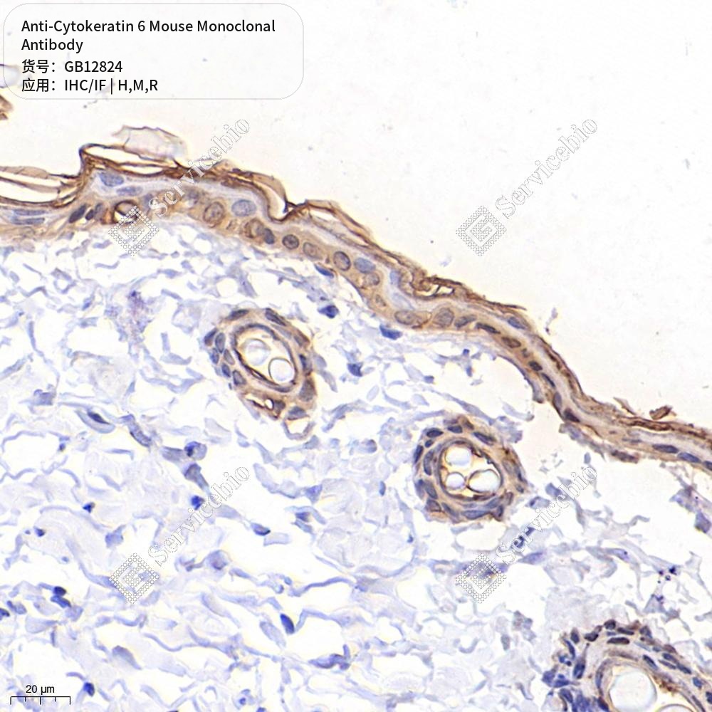 Антитела первичные, моноклональные мыши к Cytokeratin 6 крысы, мыши, человека, 50 мкл