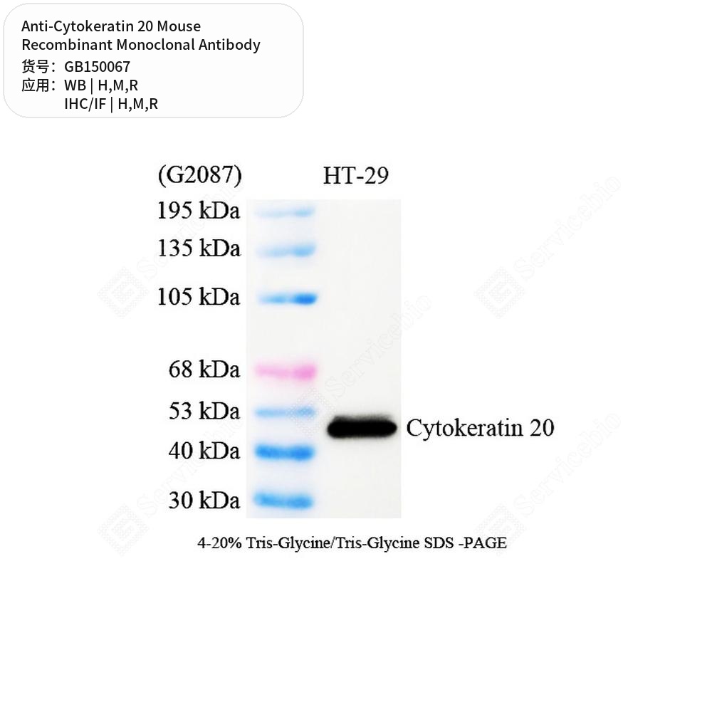 Антитела первичные, моноклональные мыши к Cytokeratin 20 крысы, мыши, человека, 50 мкл