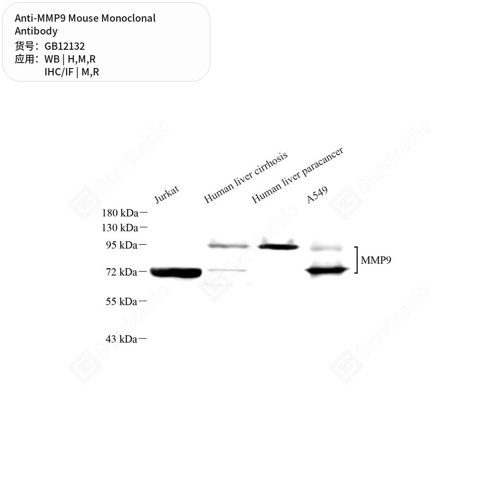 Антитела первичные, моноклональные мыши к MMP9 крысы, мыши, человека, 50 мкл
