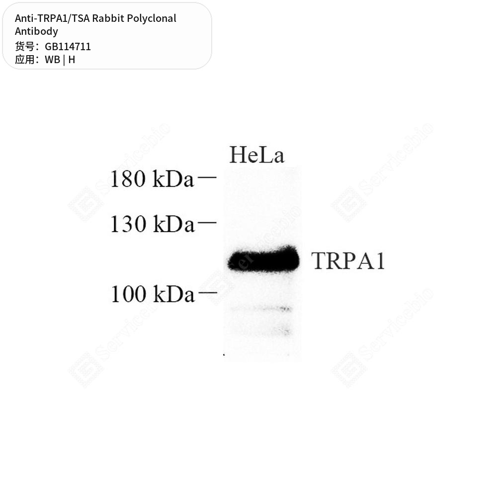 Антитела первичные, поликлональные кролика к TRPA1/TSA человека, 50 мкл