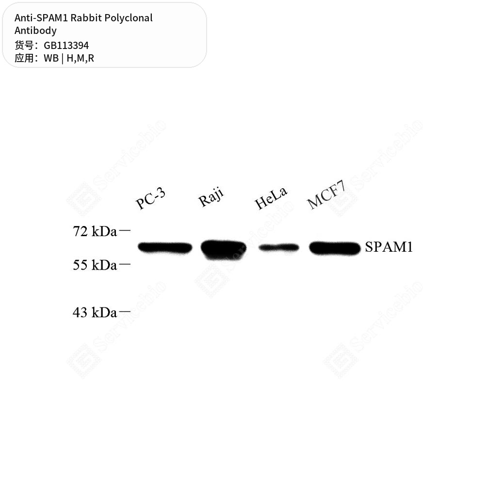 Антитела первичные, поликлональные кролика к SPAM1 крысы, мыши, человека, 100 мкл