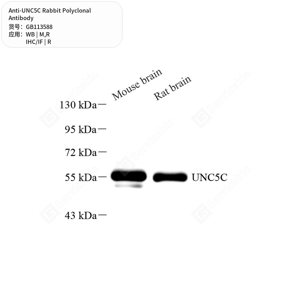 Антитела первичные, поликлональные кролика к UNC5C крысы, мыши, 100 мкл