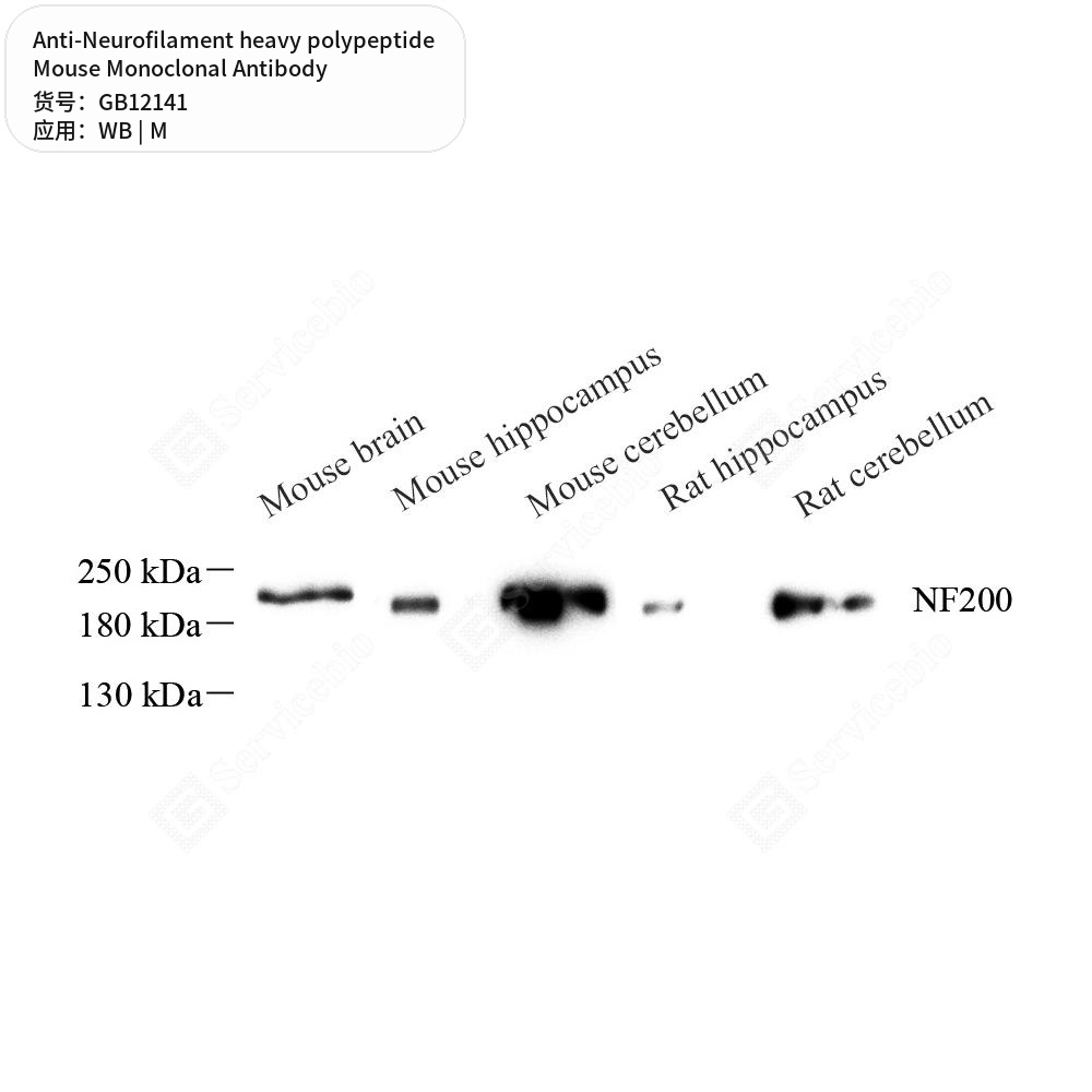 Антитела первичные, моноклональные мыши к Neurofilament heavy polypeptide мыши, 50 мкл