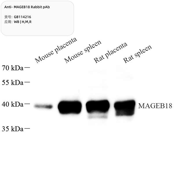 Антитела первичные, поликлональные, MAGEB18, 100 мкл