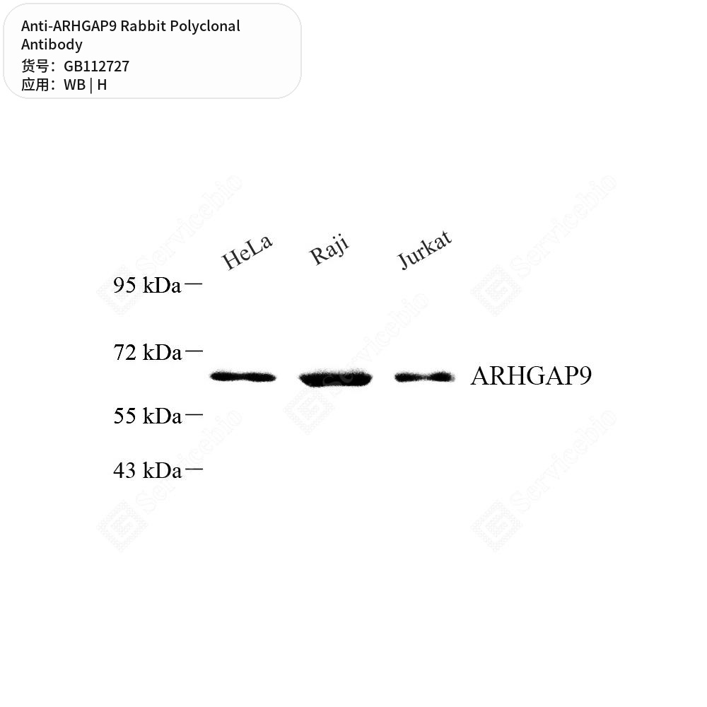 Антитела первичные, поликлональные кролика к ARHGAP9 человека, 100 мкл