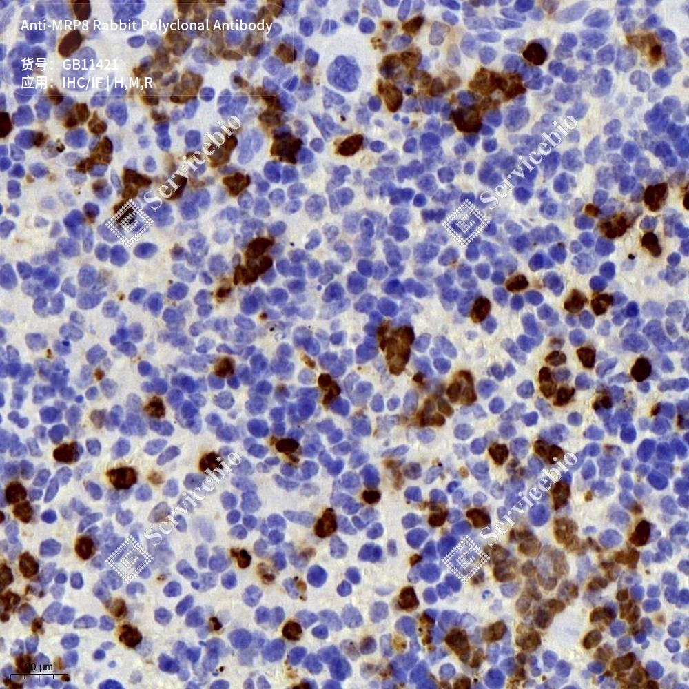 Антитела первичные, поликлональные кролика к MRP8 крысы, мыши, человека, 100 мкл