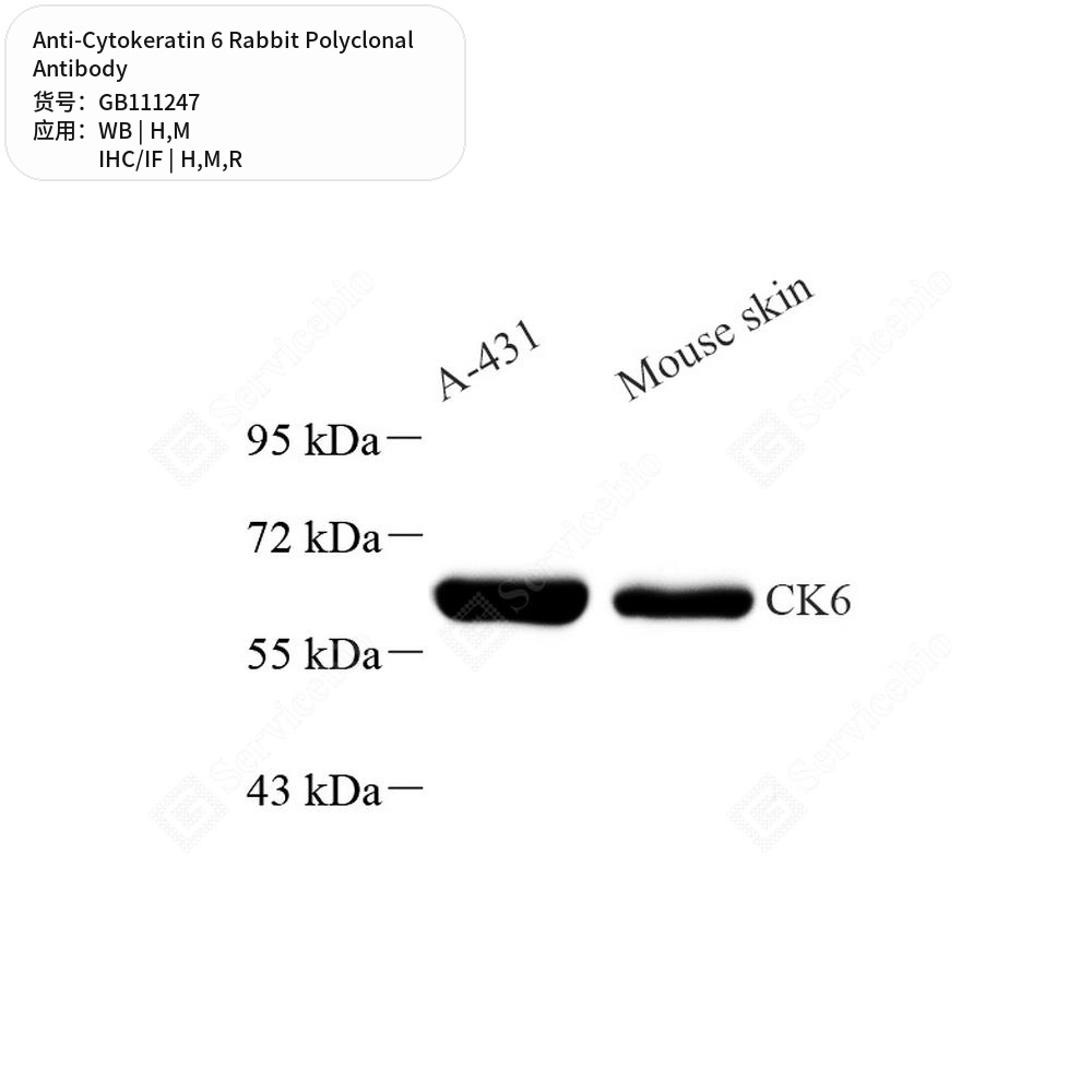 Антитела первичные, поликлональные кролика к Cytokeratin 6 крысы, мыши, человека, 100 мкл