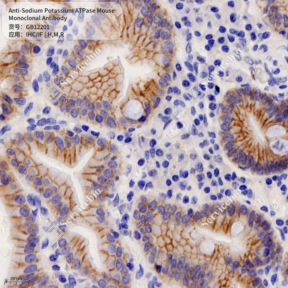 Антитела первичные, моноклональные мыши к Sodium Potassium ATPase крысы, мыши, человека, 50 мкл