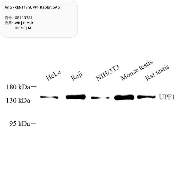 Антитела первичные, поликлональные, RENT1/hUPF1, 100 мкл