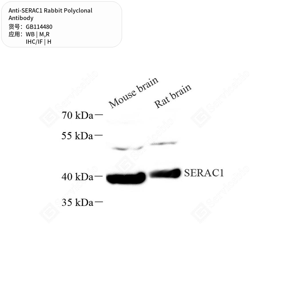 Антитела первичные, поликлональные кролика к SERAC1 крысы, мыши, человека, 50 мкл