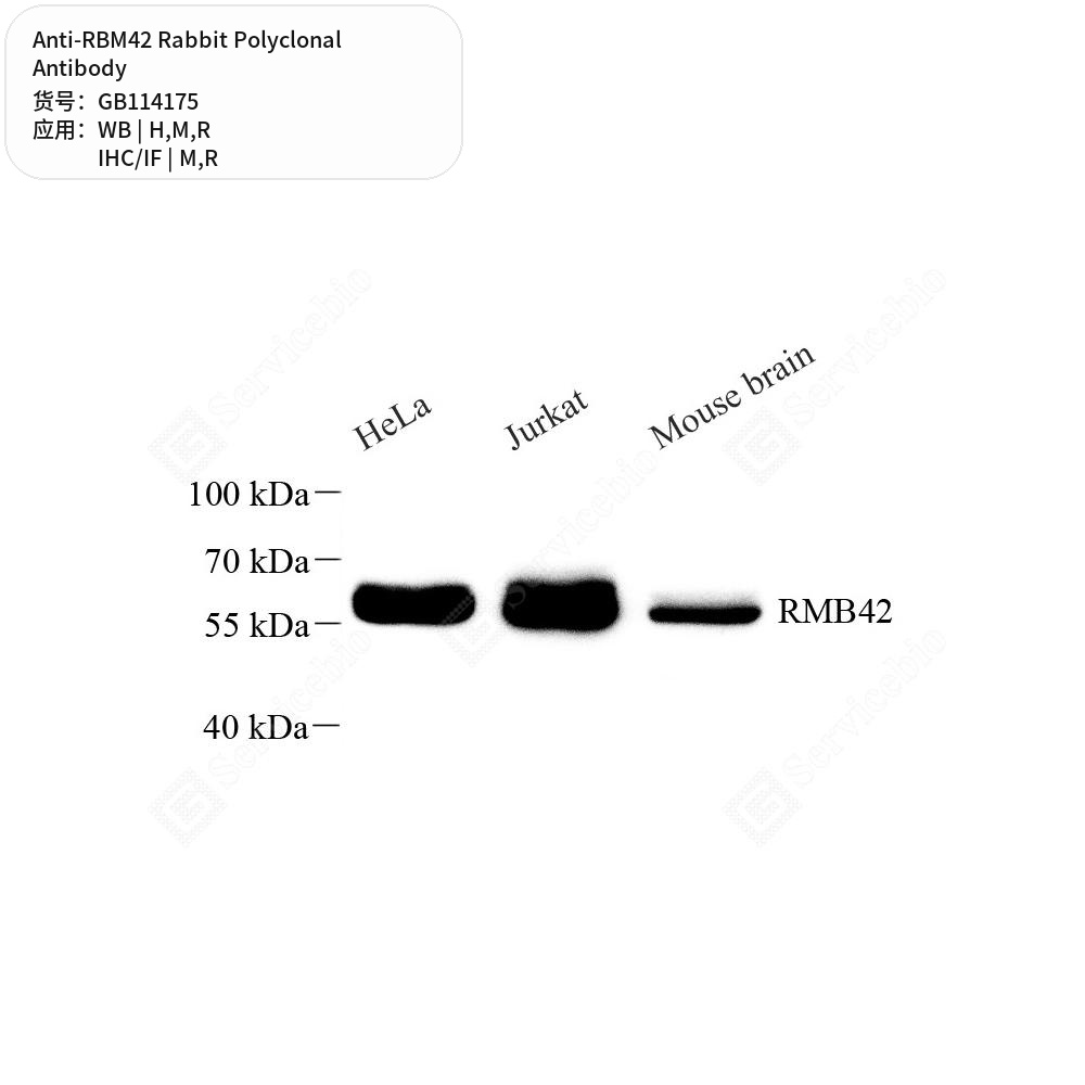 Антитела первичные, поликлональные кролика к RBM42 крысы, мыши, человека, 50 мкл