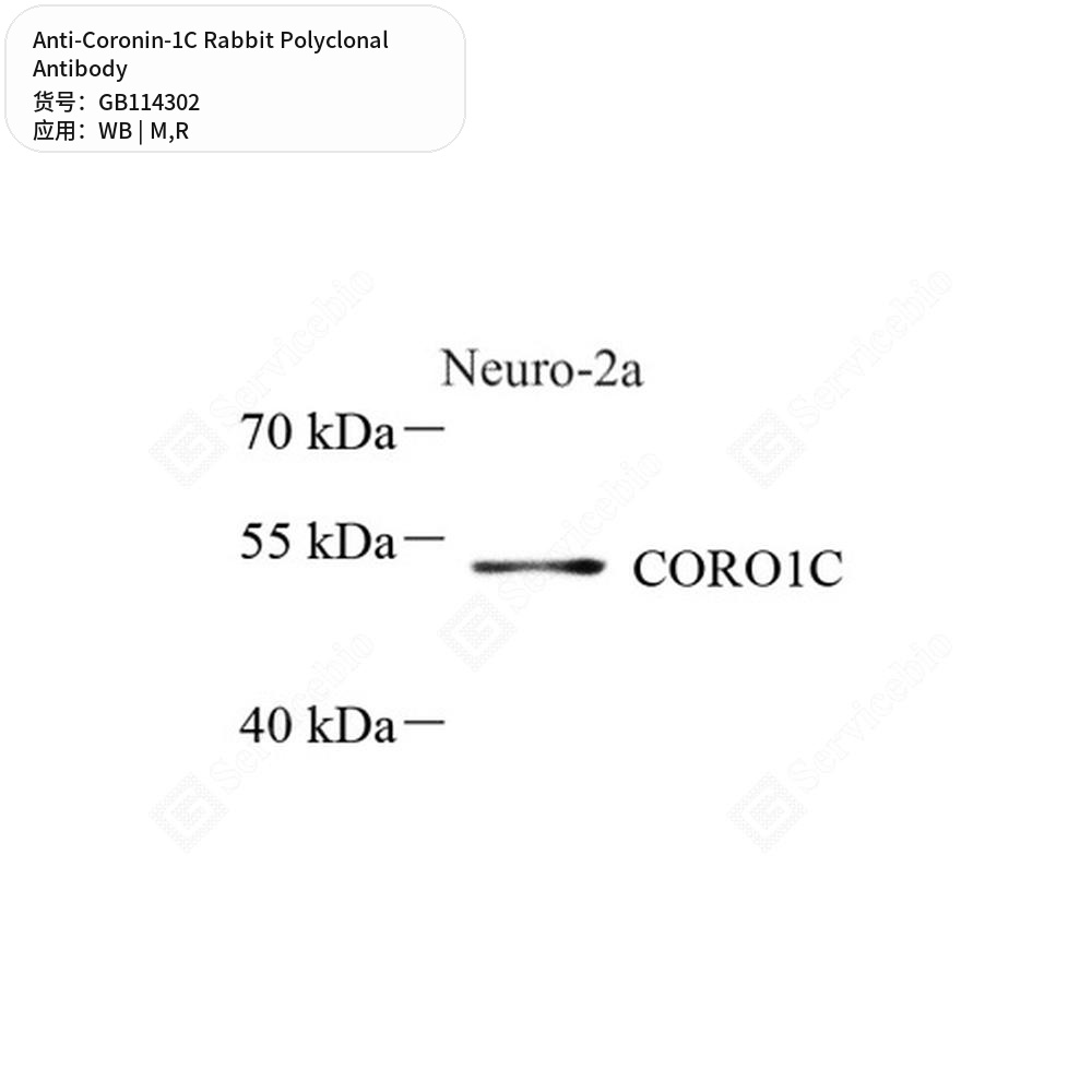 Антитела первичные, поликлональные кролика к Coronin-1C крысы, мыши, 50 мкл