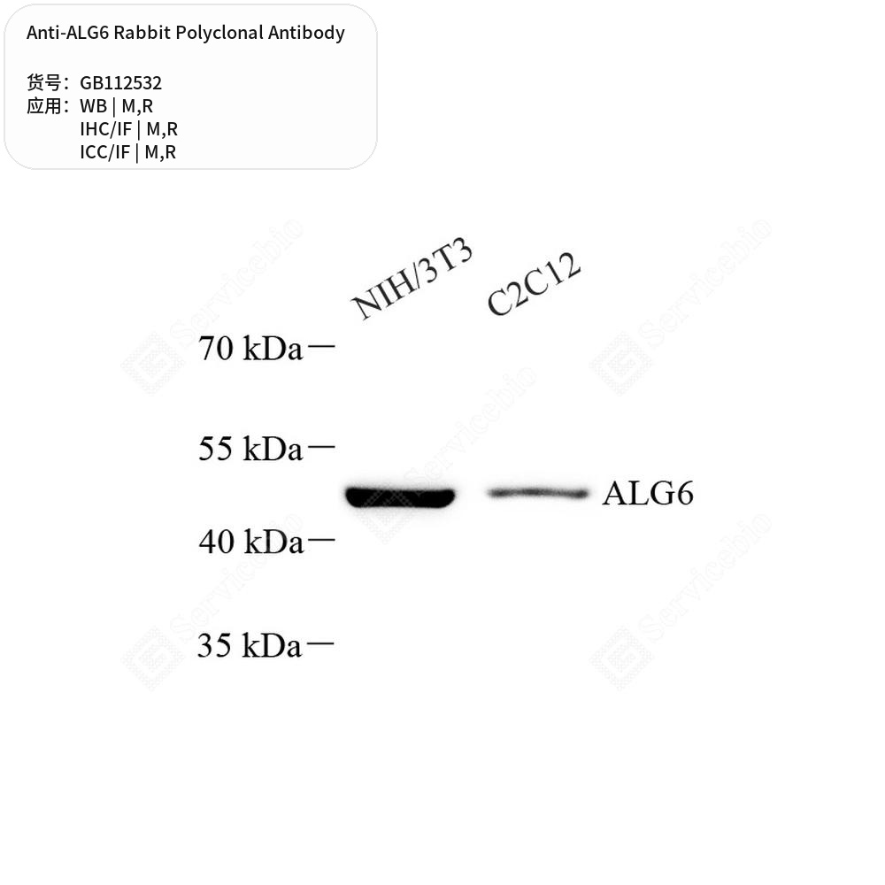 Антитела первичные, поликлональные кролика к ALG6 крысы, мыши, 100 мкл