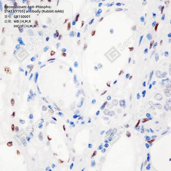 Антитела первичные, моноклональные, Phospho-STAT3(Tyr705), 100 мкл