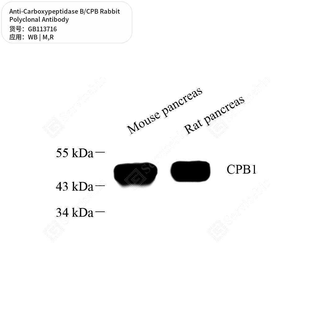 Антитела первичные, поликлональные кролика к Carboxypeptidase B/CPB крысы, мыши, 100 мкл