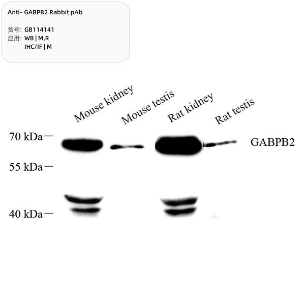 Антитела первичные, поликлональные, GABPB2, 100 мкл