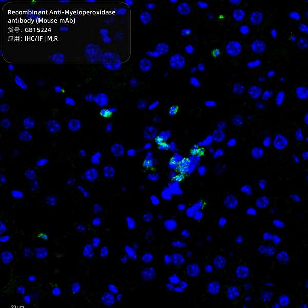 Антитела первичные, моноклональные, Myeloperoxidase, 100 мкл
