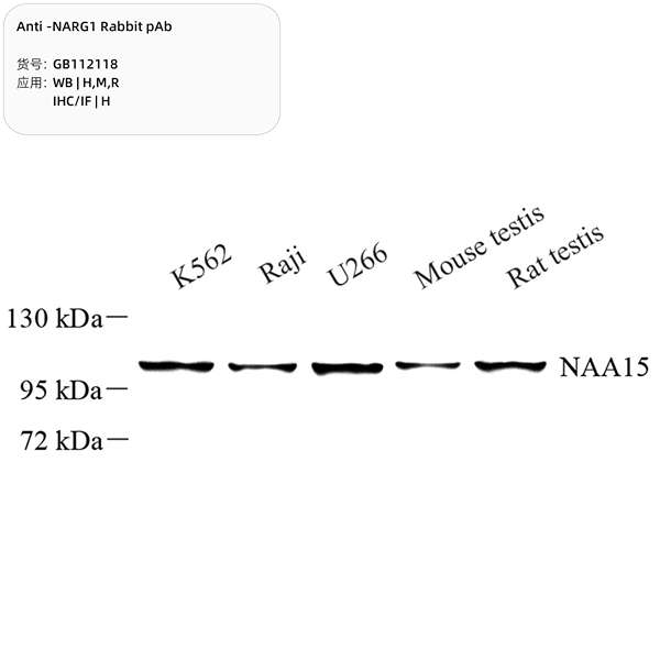 Антитела первичные, поликлональные, NARG1, 100 мкл